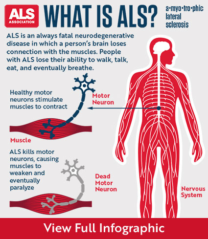 What is ALS - Infographic